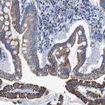 ZDHC3 Polyclonal Antibody