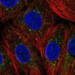 ZDHHC24 Polyclonal Antibody