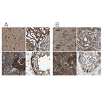 ARFGAP2 Antibody in Immunohistochemistry (IHC)