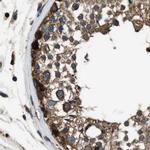 ARFGAP2 Antibody in Immunohistochemistry (IHC)