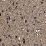 ARFGAP2 Antibody in Immunohistochemistry (IHC)