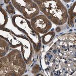 ARFGAP2 Antibody in Immunohistochemistry (IHC)