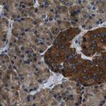 ARFGAP2 Antibody in Immunohistochemistry (IHC)