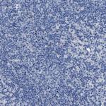 SLC10A6 Polyclonal Antibody