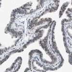 HIPK1 Antibody in Immunohistochemistry (Paraffin) (IHC (P))