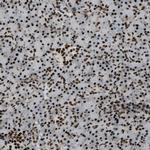 ZFR Antibody in Immunohistochemistry (Paraffin) (IHC (P))