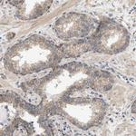 CTXN1 Antibody in Immunohistochemistry (Paraffin) (IHC (P))
