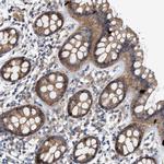 CTXN1 Antibody in Immunohistochemistry (Paraffin) (IHC (P))