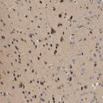 CTXN1 Antibody in Immunohistochemistry (IHC)