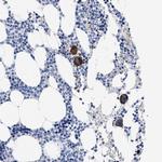 TREML1 Polyclonal Antibody
