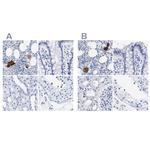 TREML1 Antibody in Immunohistochemistry (IHC)
