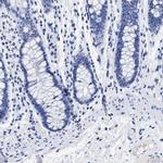 TREML1 Antibody in Immunohistochemistry (IHC)