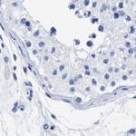 TREML1 Antibody in Immunohistochemistry (IHC)