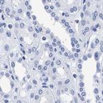 TREML1 Antibody in Immunohistochemistry (IHC)