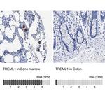 TREML1 Antibody
