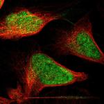 p400 Polyclonal Antibody