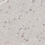 p400 Antibody in Immunohistochemistry (Paraffin) (IHC (P))