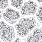 SP100 Antibody in Immunohistochemistry (IHC)