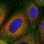 CNNM3 Polyclonal Antibody