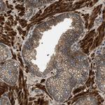 CNNM3 Antibody in Immunohistochemistry (Paraffin) (IHC (P))