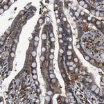 SLC15A4 Antibody in Immunohistochemistry (IHC)