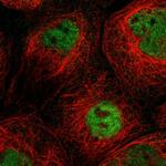 SLC15A4 Polyclonal Antibody