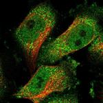 TMTC1 Polyclonal Antibody