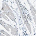 TMTC1 Antibody in Immunohistochemistry (Paraffin) (IHC (P))