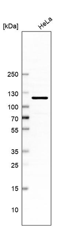 TMTC1 Antibody in Western Blot (WB)