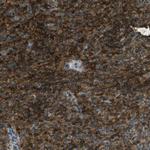 TMTC1 Antibody in Immunohistochemistry (IHC)