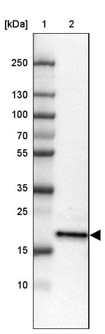ZNF22 Antibody in Western Blot (WB)