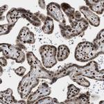 ZNF22 Antibody in Immunohistochemistry (IHC)