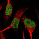 SMARCAD1 Polyclonal Antibody