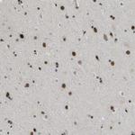 SMARCAD1 Antibody in Immunohistochemistry (Paraffin) (IHC (P))