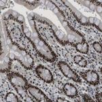 SMARCAD1 Antibody in Immunohistochemistry (Paraffin) (IHC (P))