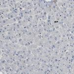 SMARCAD1 Antibody in Immunohistochemistry (Paraffin) (IHC (P))