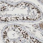 SMARCAD1 Antibody in Immunohistochemistry (Paraffin) (IHC (P))