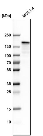 SMARCAD1 Antibody in Western Blot (WB)
