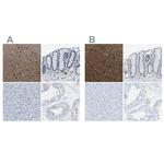MAPRE2 Polyclonal Antibody