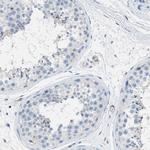 MAPRE2 Antibody in Immunohistochemistry (IHC)
