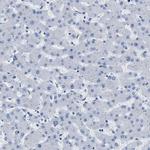 MAPRE2 Antibody in Immunohistochemistry (IHC)