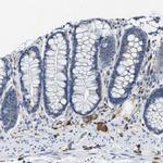 MAPRE2 Antibody in Immunohistochemistry (IHC)