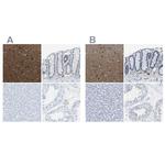 MAPRE2 Polyclonal Antibody