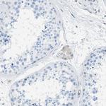 MAPRE2 Antibody in Immunohistochemistry (IHC)