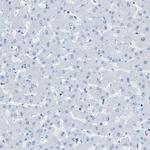 MAPRE2 Antibody in Immunohistochemistry (IHC)