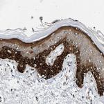 RAPH1 Polyclonal Antibody