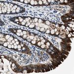 PTPDC1 Antibody in Immunohistochemistry (Paraffin) (IHC (P))