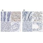 XIRP1 Polyclonal Antibody