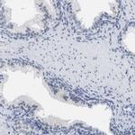 XIRP1 Antibody in Immunohistochemistry (IHC)
