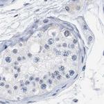 XIRP1 Antibody in Immunohistochemistry (IHC)